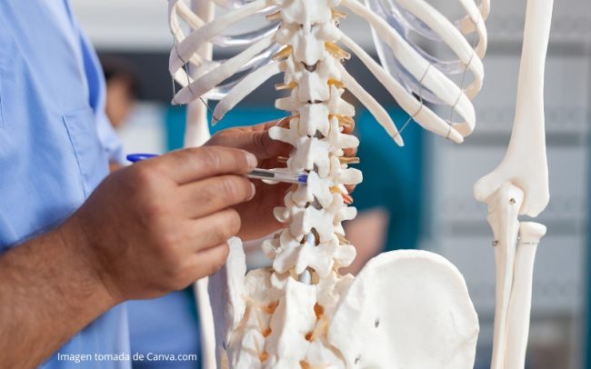 Osteoporosis en Medellín