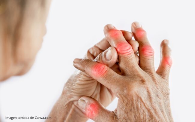 Dolor Articular en Medellín