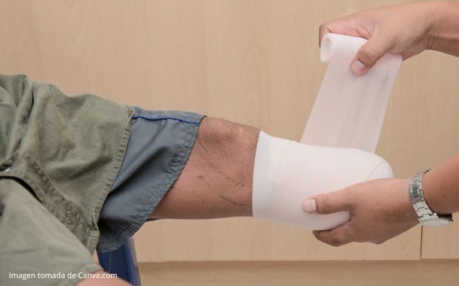 Tratamientos para el Dolor por Amputación en Medellín