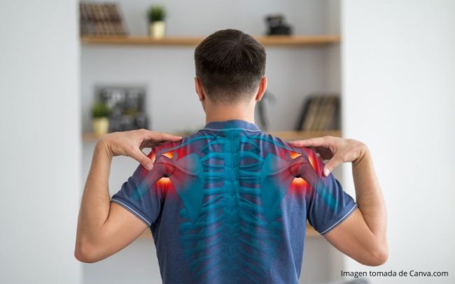 Capsulitis_adhesiva_en_Medellin